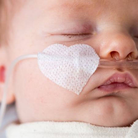 婴儿用呼吸管